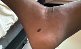 老哥们硅胶娃娃脚腕开裂了怎么办