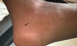 老哥们硅胶娃娃脚腕开裂了怎么办