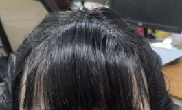 硅胶植发头雕
